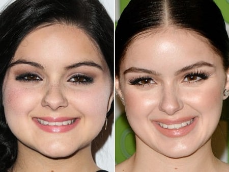 Ariel Winter before (left) and after (right).